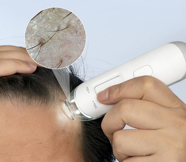 頭皮檢測儀原理
